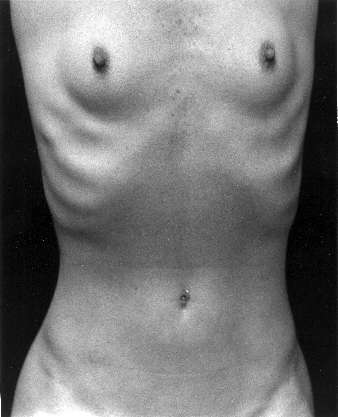 Torso